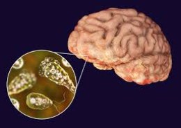 How does a brain eating amoeba enter the human body?