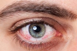 Prescription vs. OTC Eye Treatments for Dry Eyes: Pros and Cons