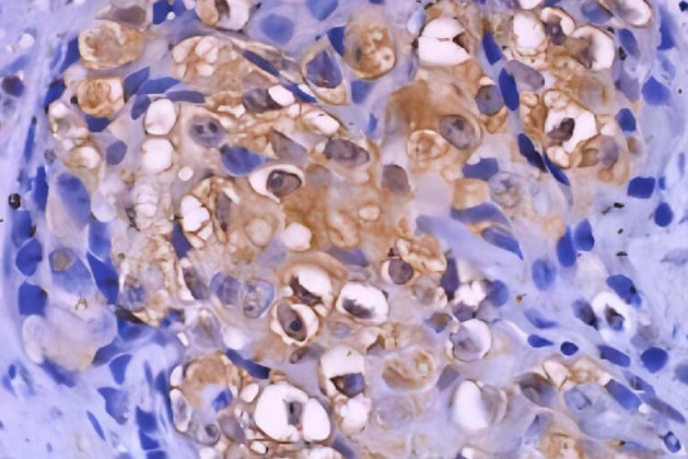 DS IHC Kits for Human and Rodent Tissues