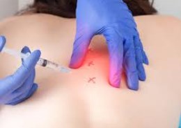 Where to Find Affordable Trigger Point Injections Near Me?