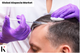 Alopecia Market Growth in Future Scope 2024-2031 | Johnson & Johnson Services, Cipla, Merck KGaA